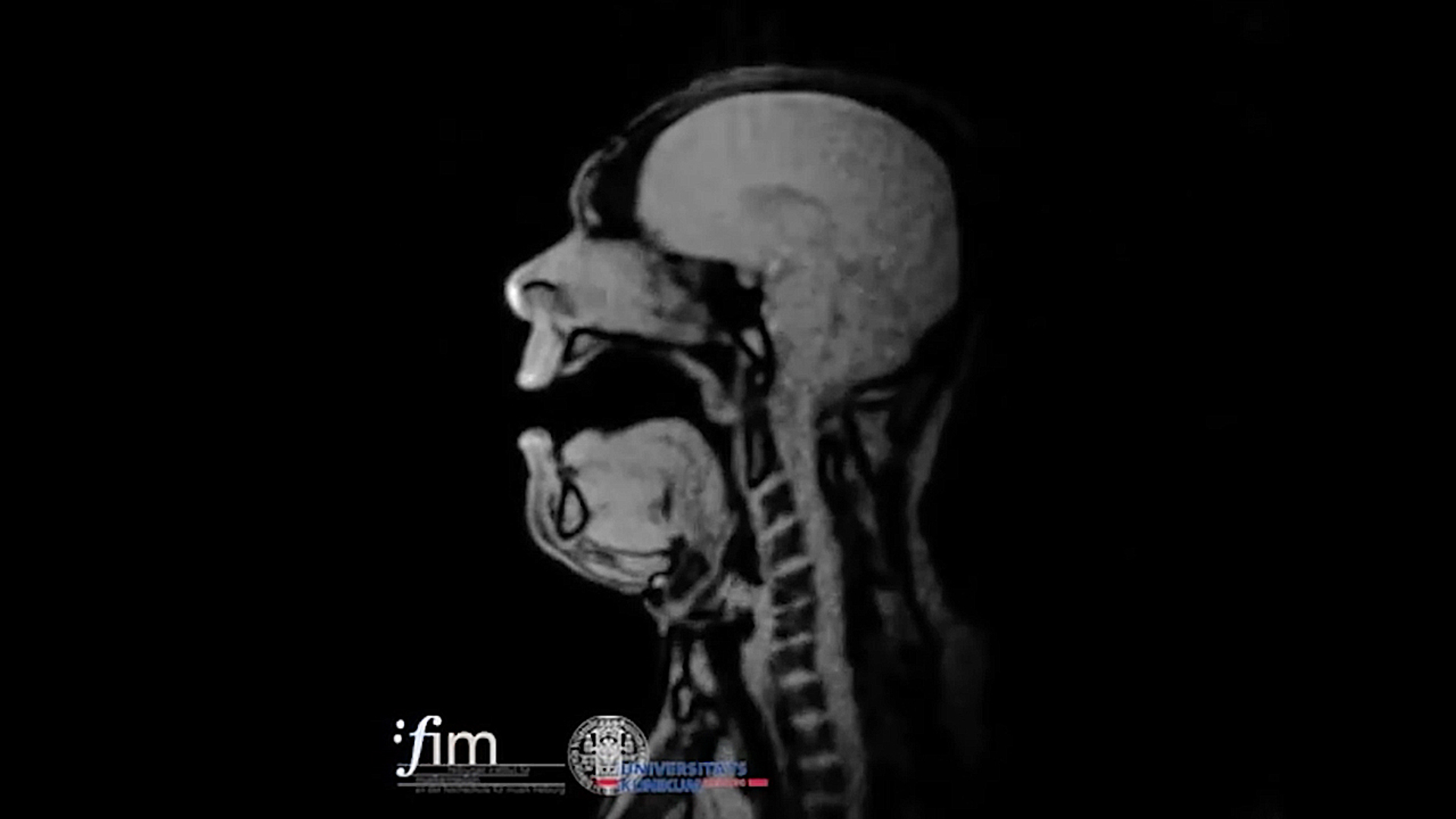 Opera zingen in een MRI-scan