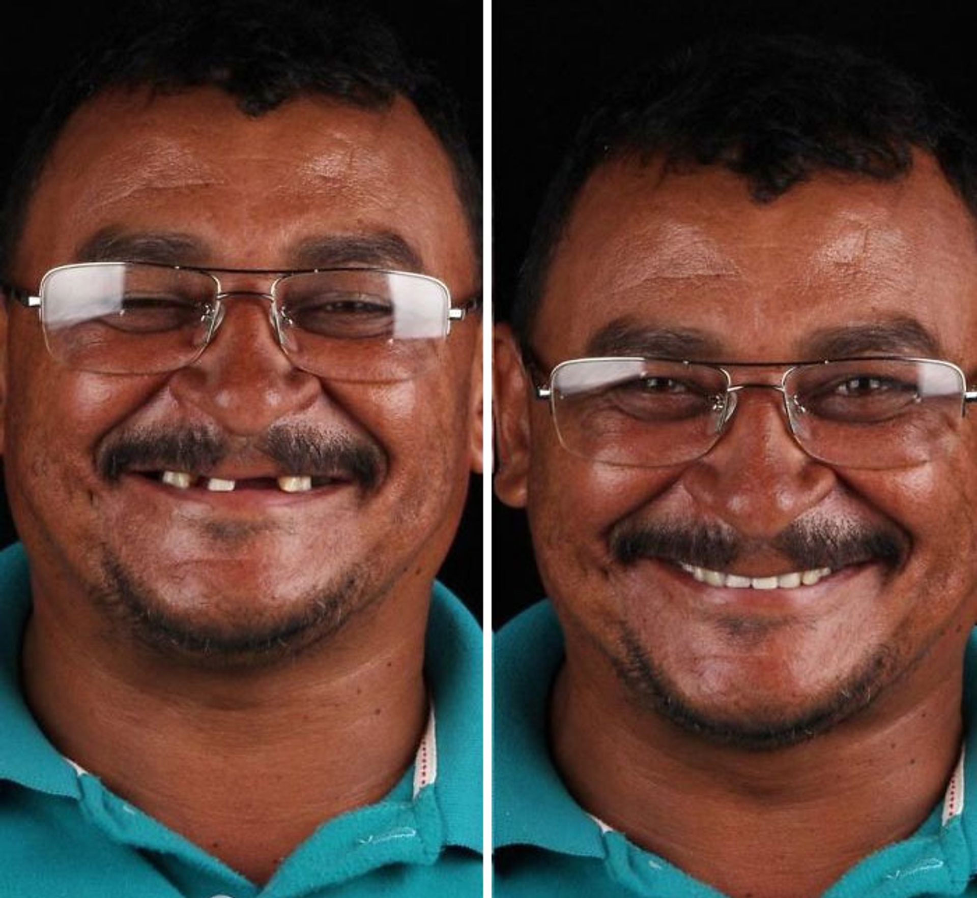brazilian-dentist-travel-poor-people-teeth-fix-felipe-rossi-36-5db9502187fb1__700