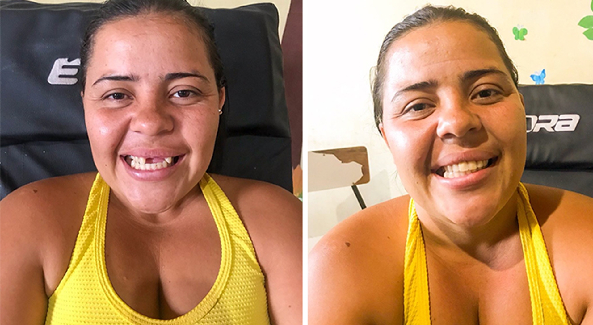 brazilian-dentist-travel-poor-people-teeth-fix-felipe-rossi-30-5db941ba7cb0a__700