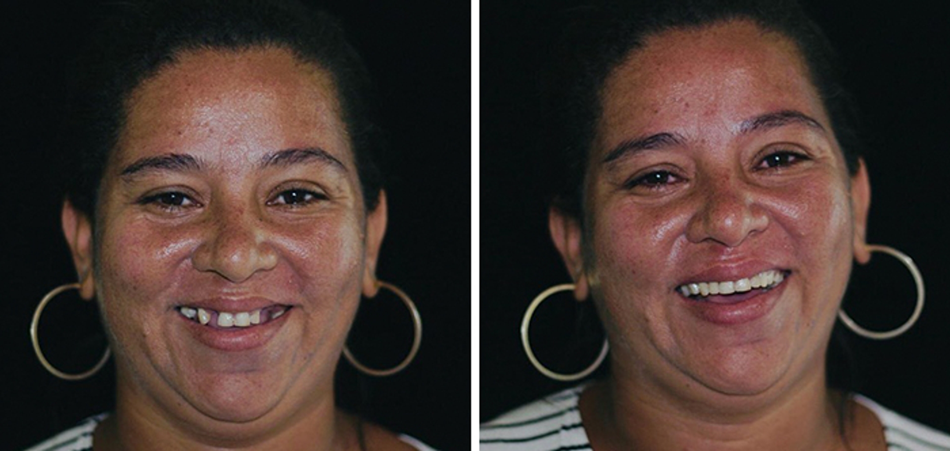 brazilian-dentist-travel-poor-people-teeth-fix-felipe-rossi-24-5db941af5d19b__700
