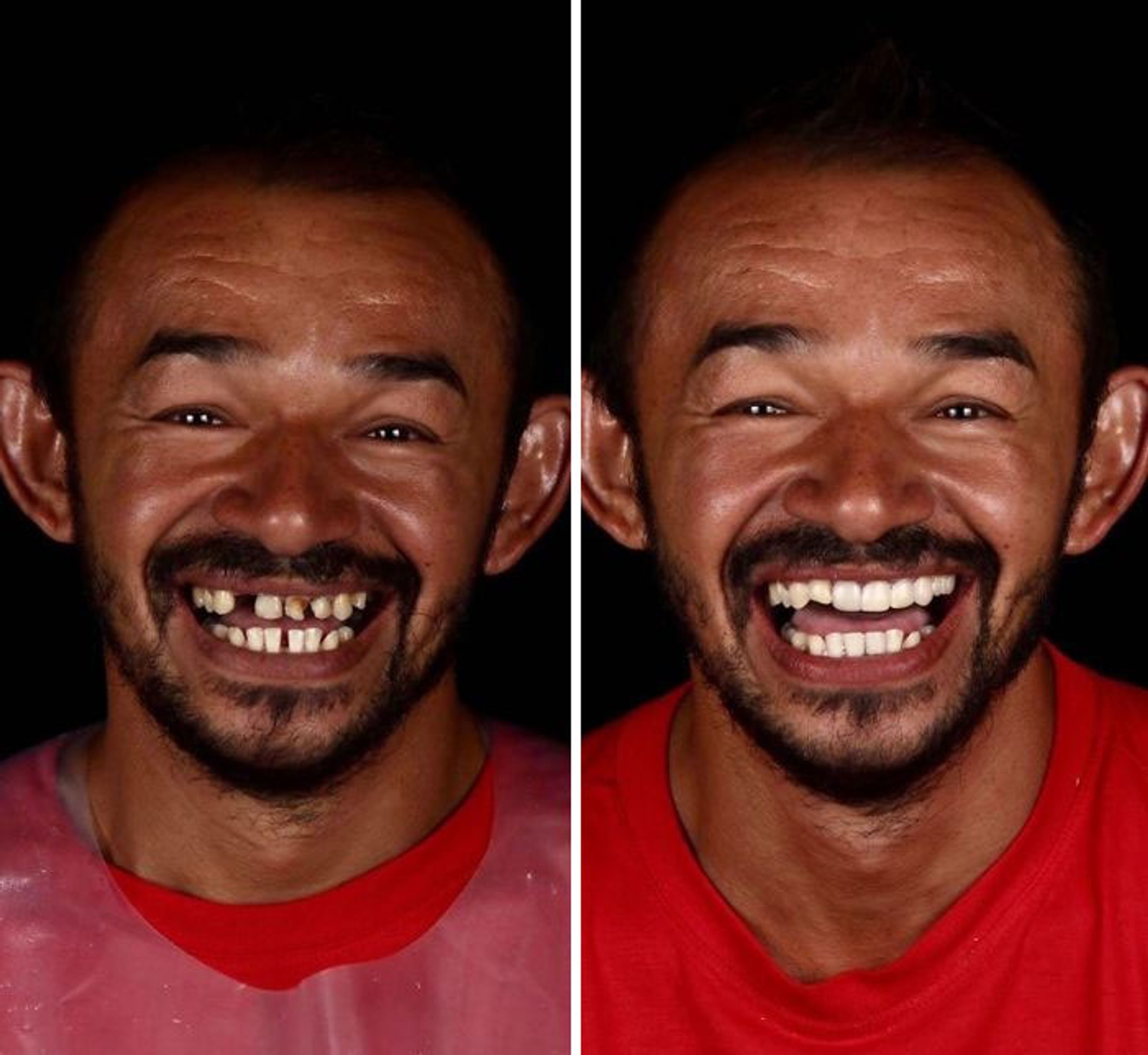 brazilian-dentist-travel-poor-people-teeth-fix-felipe-rossi-34-5db94fcb2d758__700