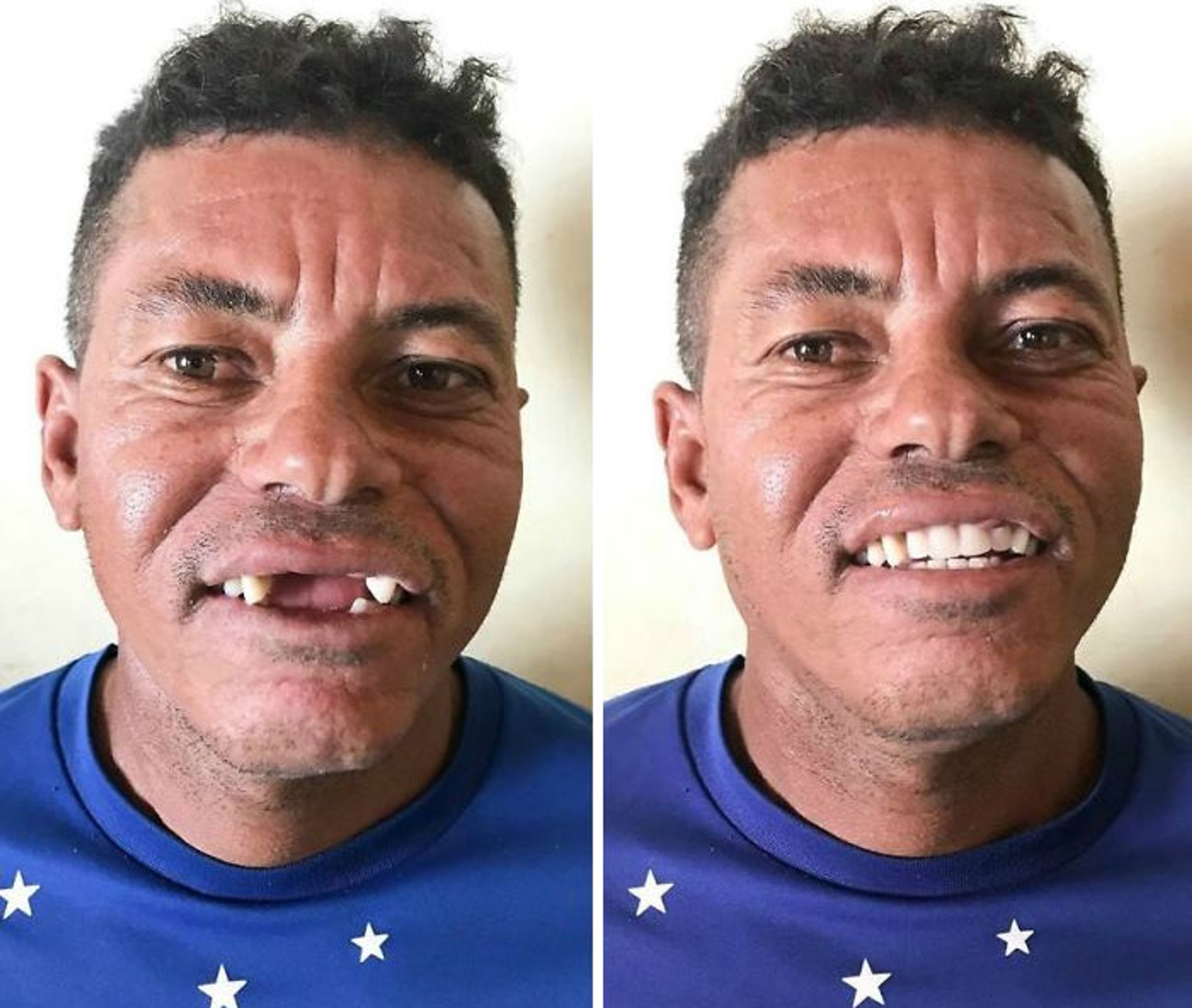 brazilian-dentist-travel-poor-people-teeth-fix-felipe-rossi-43-5db954348afc6__700