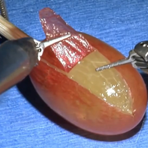 Web Draait Door: chirurgisch een druif pellen